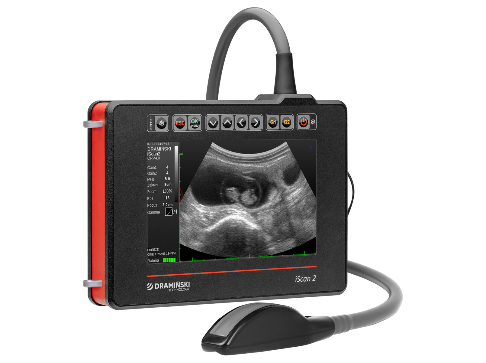 iScan 2 ultrasound scanner - Dramiński