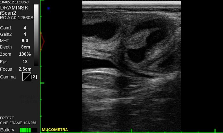 iScan 2 ultrasound scanner - Dramiński