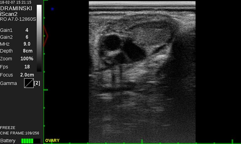 iScan 2 ultrasound scanner - Dramiński
