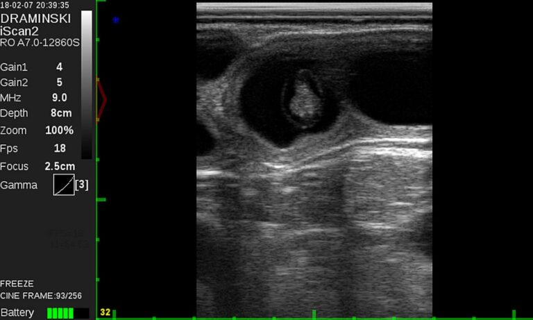iScan 2 ultrasound scanner - Dramiński