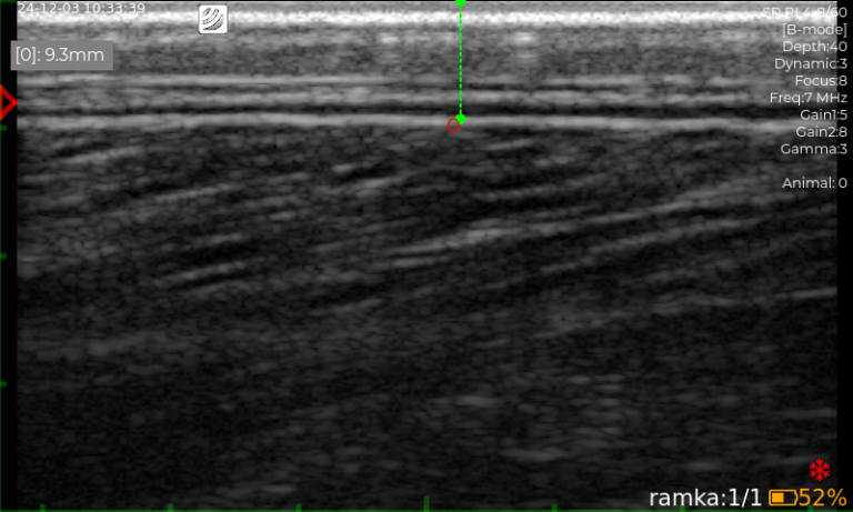 iScan 3 ultrasound scanner - Dramiński