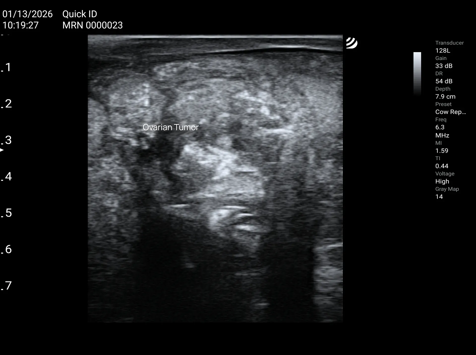 Ovarian and Uterine Tumors in Cows - Dramiński