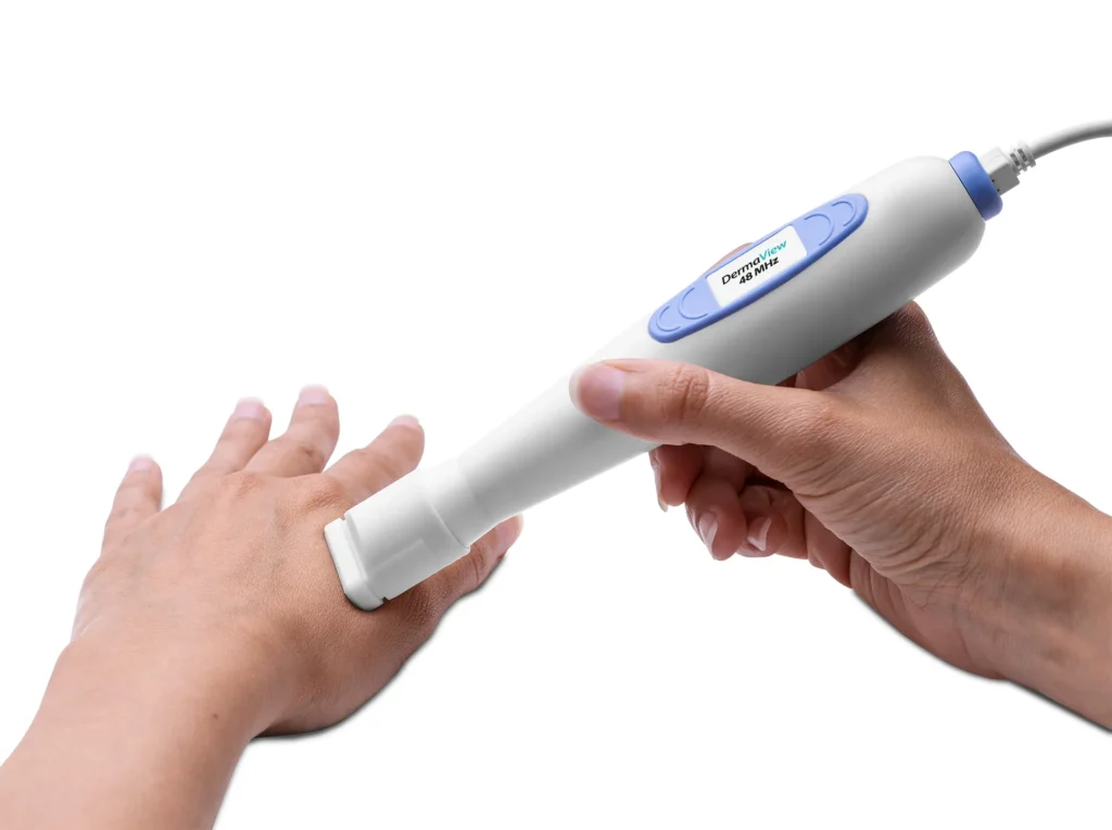 ultrasonograf usg dla lekarza dermatologa kosmetologa